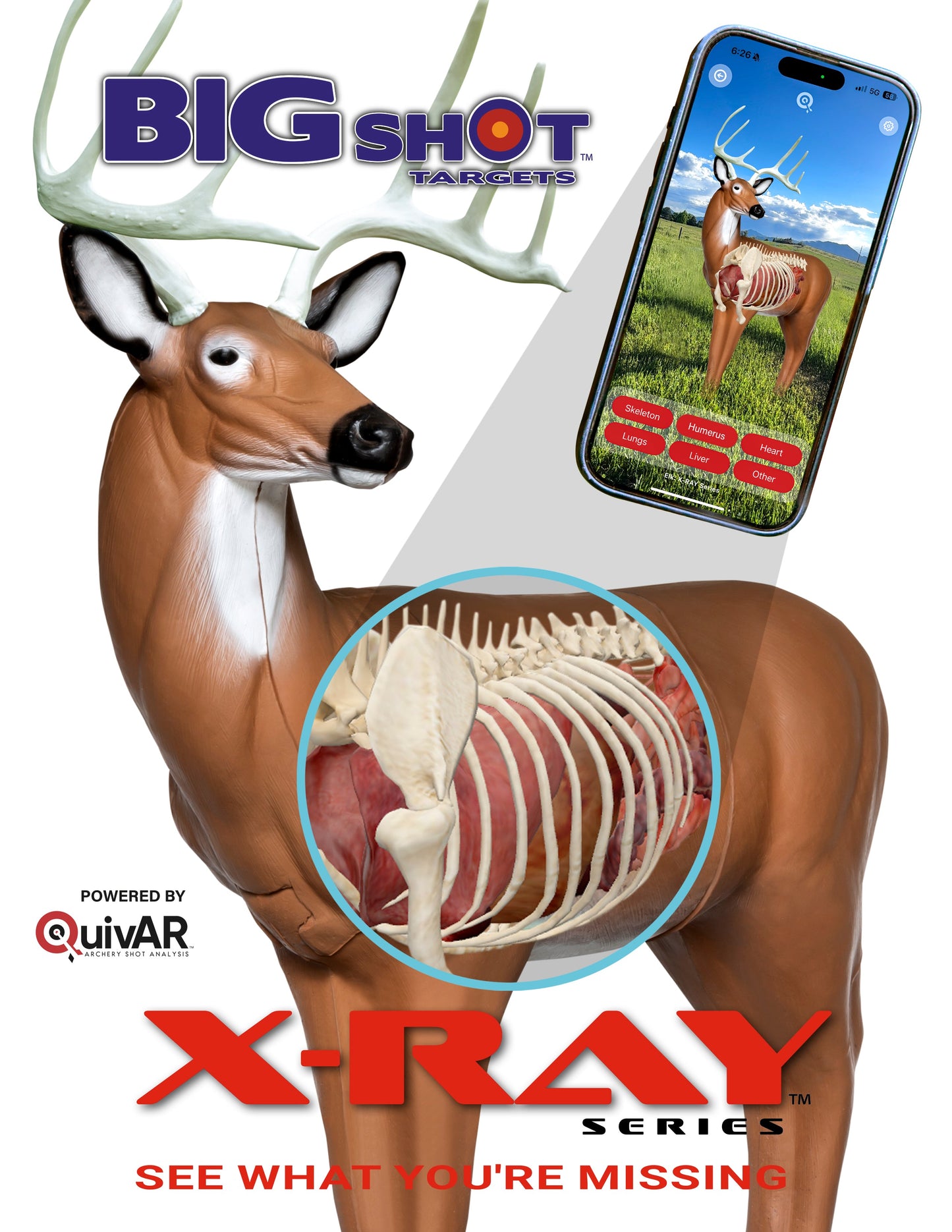 X-Ray Series Big Buck